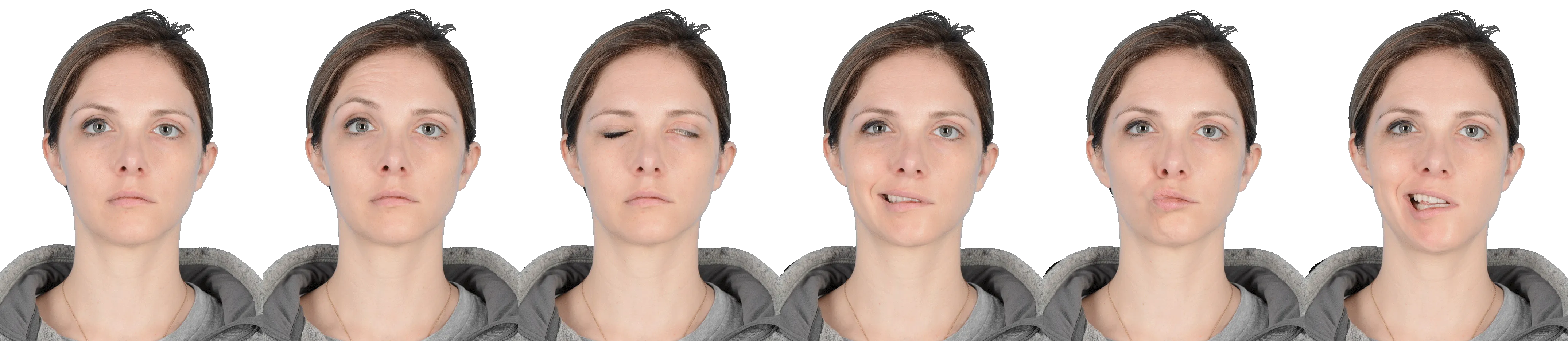 Sequential photographs showing facial paralysis expressions