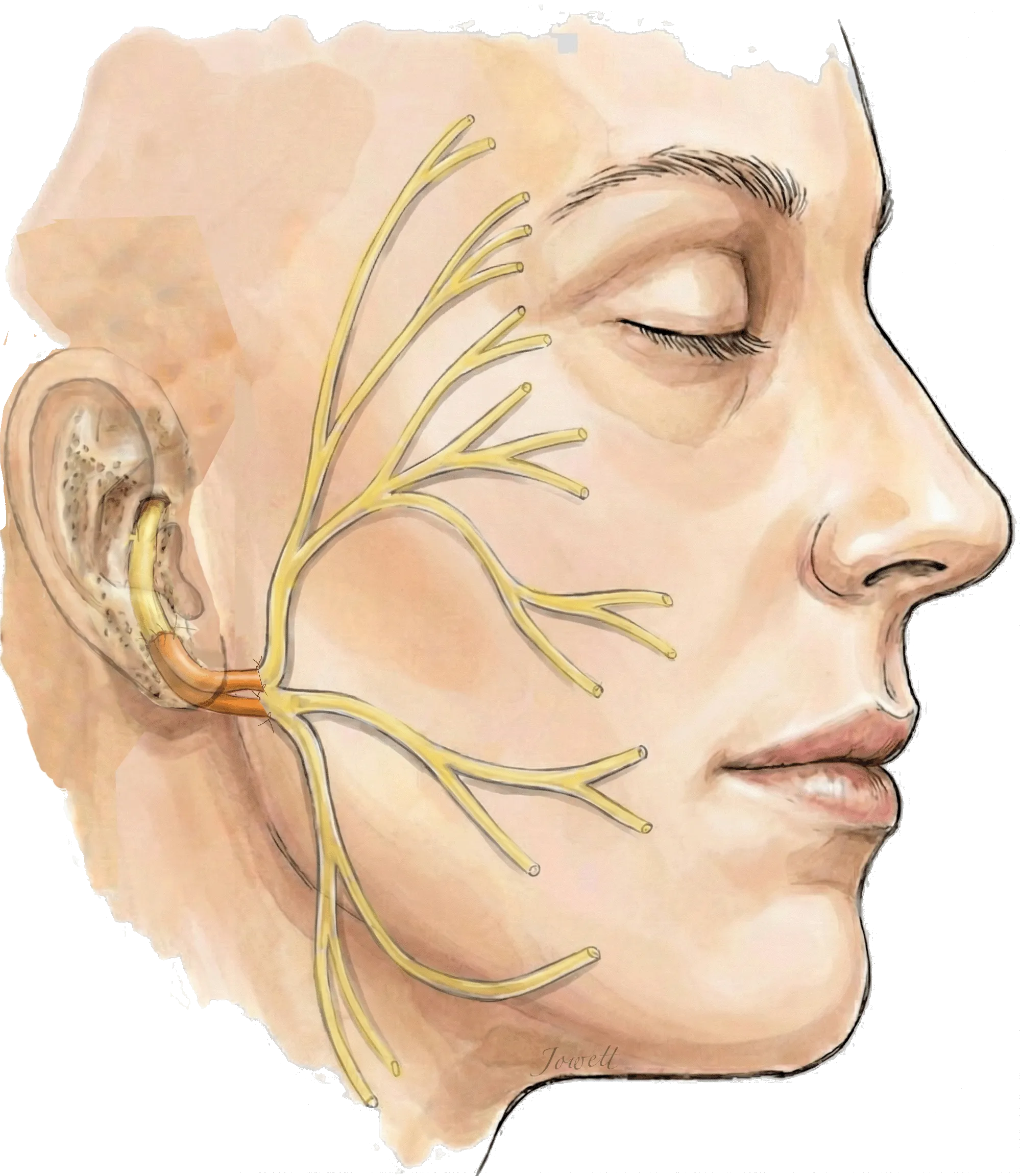Facial Nerve Repair